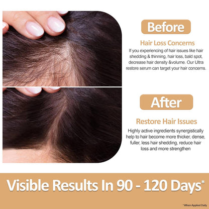 Nirvana Nurture Ultra Restore Hair Growth Serum – Fuller Hair, Scalp Hydration & Detox