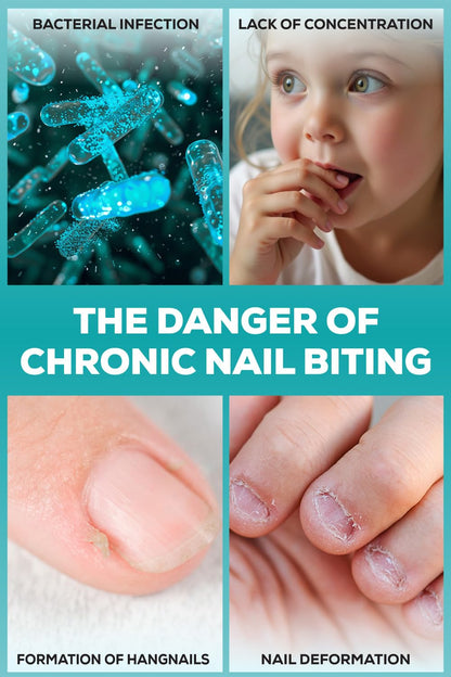 NIXXIT Nail Biting Prevention for Kids – Deterrent Pen for Nails, Cuticles & Thumb Sucking