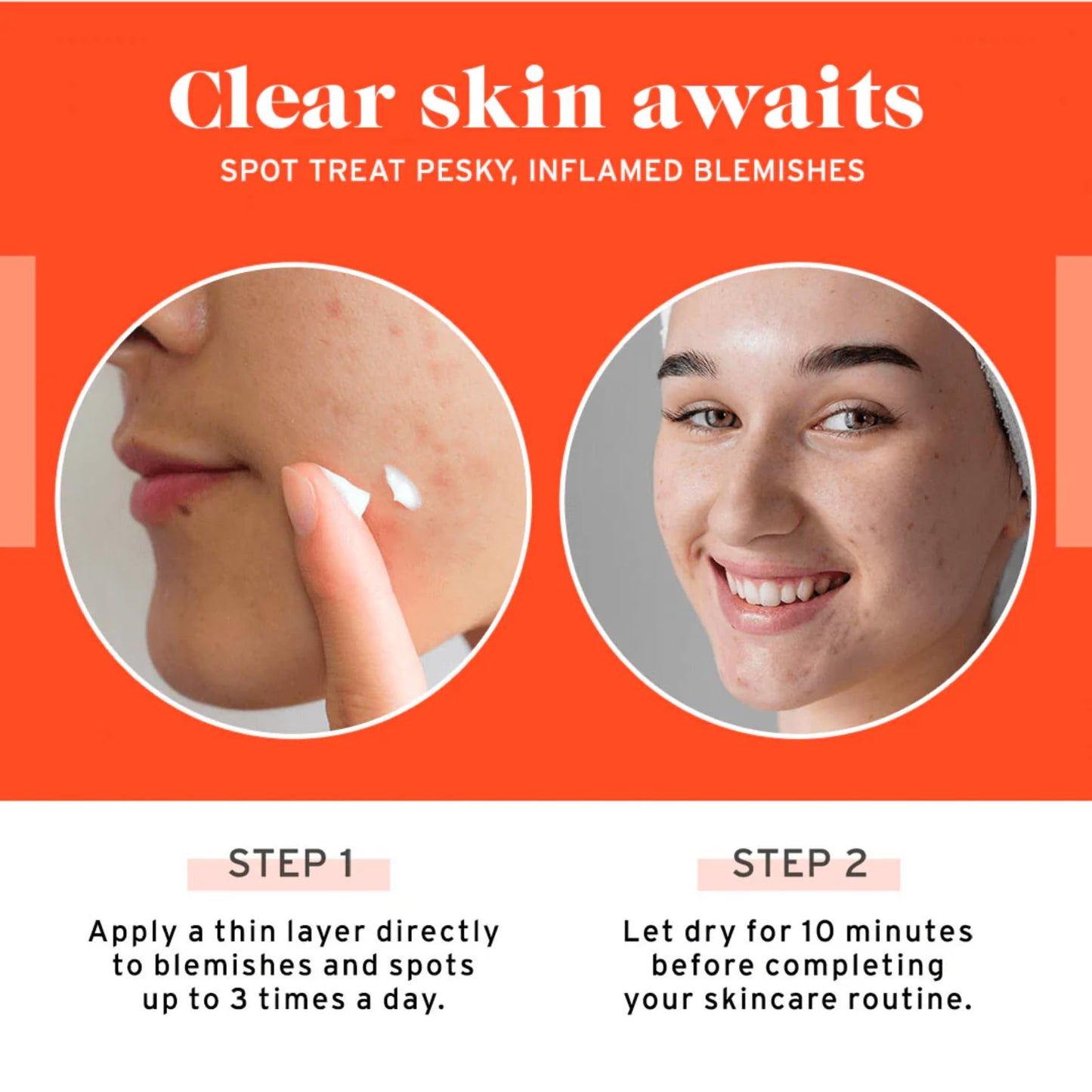 No Bad Stuff Acne Spot Treatment – 2% Salicylic Acid, Chamomile & Aloe Vera (0.5 oz)