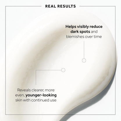 No7 Microdermabrasion Total Renewal Face Scrub – Gentle Exfoliator for Sensitive Skin & Even Tone (2.5 oz)