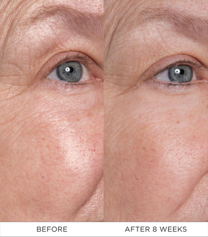 Noble Panacea Eye Lift Concentrate 12 Doses Refill | Luxury Eye Cream for Lifting & Firming
