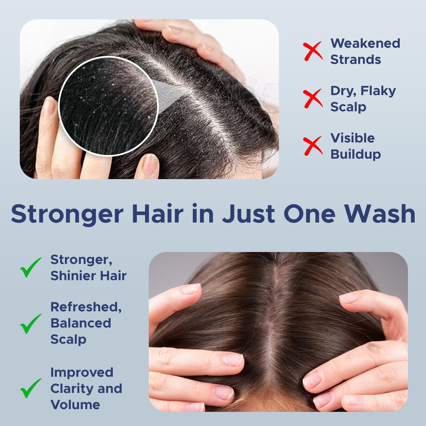 Nora Ross Garlic Extract Hair Strengthening Shampoo – Thickening, Rosemary, 32oz
