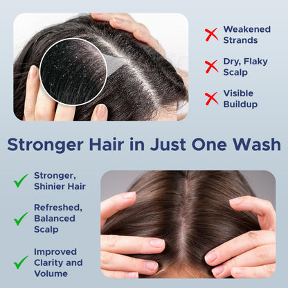 Nora Ross Garlic Extract Hair Strengthening Shampoo – Thickening, Rosemary, 32oz