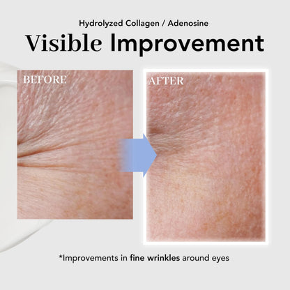 NOWATER Collagen Eye Cream for Wrinkles, Puffiness & Dark Circles | Hydrolyzed Collagen + Beta-Glucan