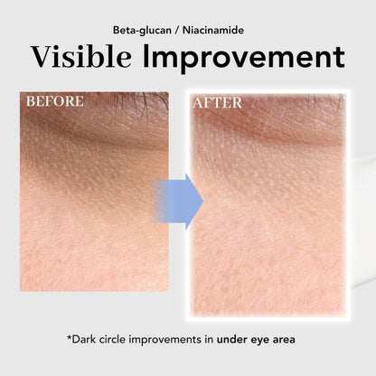 NOWATER Collagen Eye Cream for Wrinkles, Puffiness & Dark Circles | Hydrolyzed Collagen + Beta-Glucan
