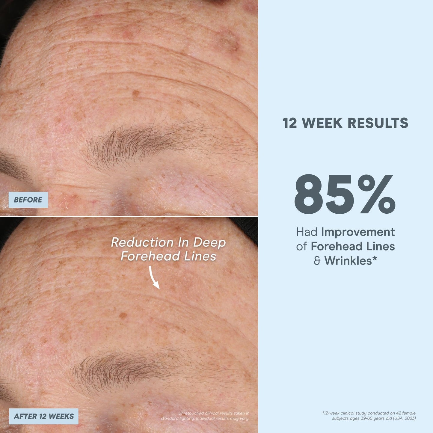NuFACE Super Peptide Booster Face Serum | Firming, Hydration & IonPlex Prep for Microcurrent