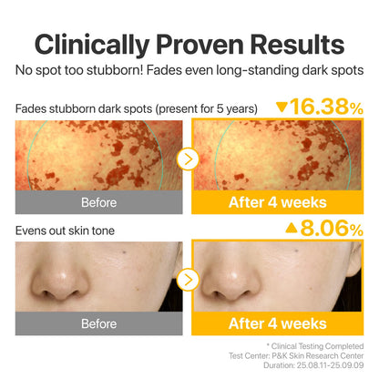 numbuzin No.5 Glutathione TXA Dark Spot Ampoule – Targeted Tone Care for Uneven Skin