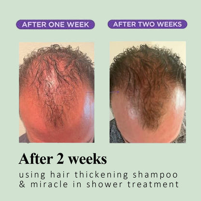 NUSQO Organic Rosemary Scalp Balance Shampoo — Gentle Cleanse for Fuller-Looking Hair