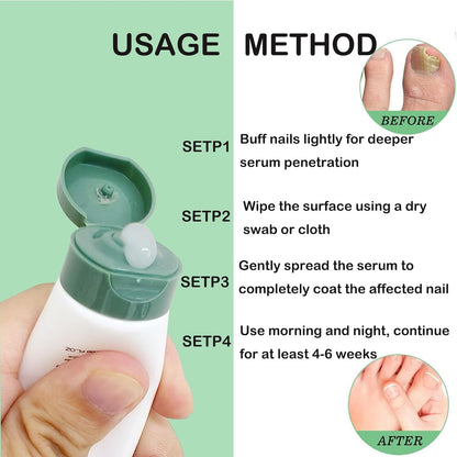 Nutraboost Natural Nail Care Gel – Strengthening Cuticle Serum for Damaged Nails, 20 ml (2-Pack)