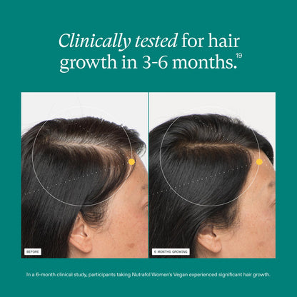 Nutrafol Women's Hair Growth Supplements - 1 Month Vegan Formula for Thicker, Stronger Hair (Ages 18-44) | Dermatologist Recommended