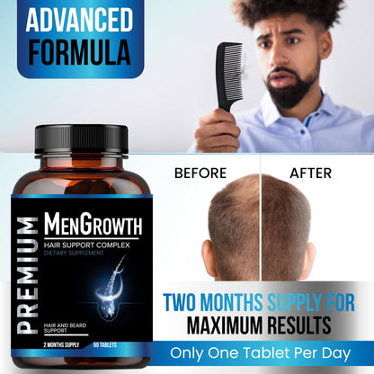 NutraPro MenGrowth Hair Growth Vitamins for Men – Biotin, Saw Palmetto & DHT Blocker