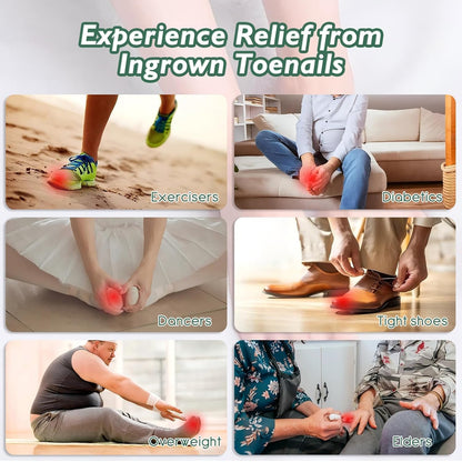 NWAKRD Ingrown Toenail Treatment Kit – 30ml Softening & Conditioning with Silicone Gel Toe Caps