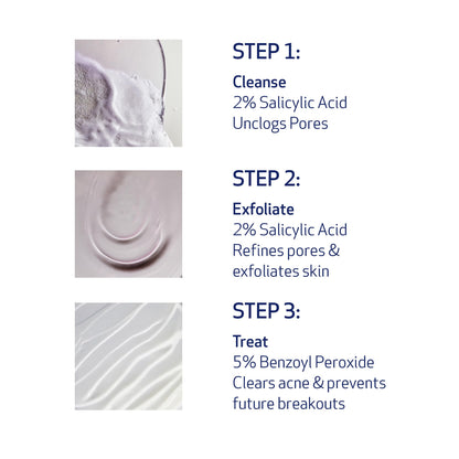 Obagi CLENZIderm M.D. Therapeutic System – 3 Step Acne Treatment with 2% BHA Cleanser, 2% BHA Toner, 5% BPO