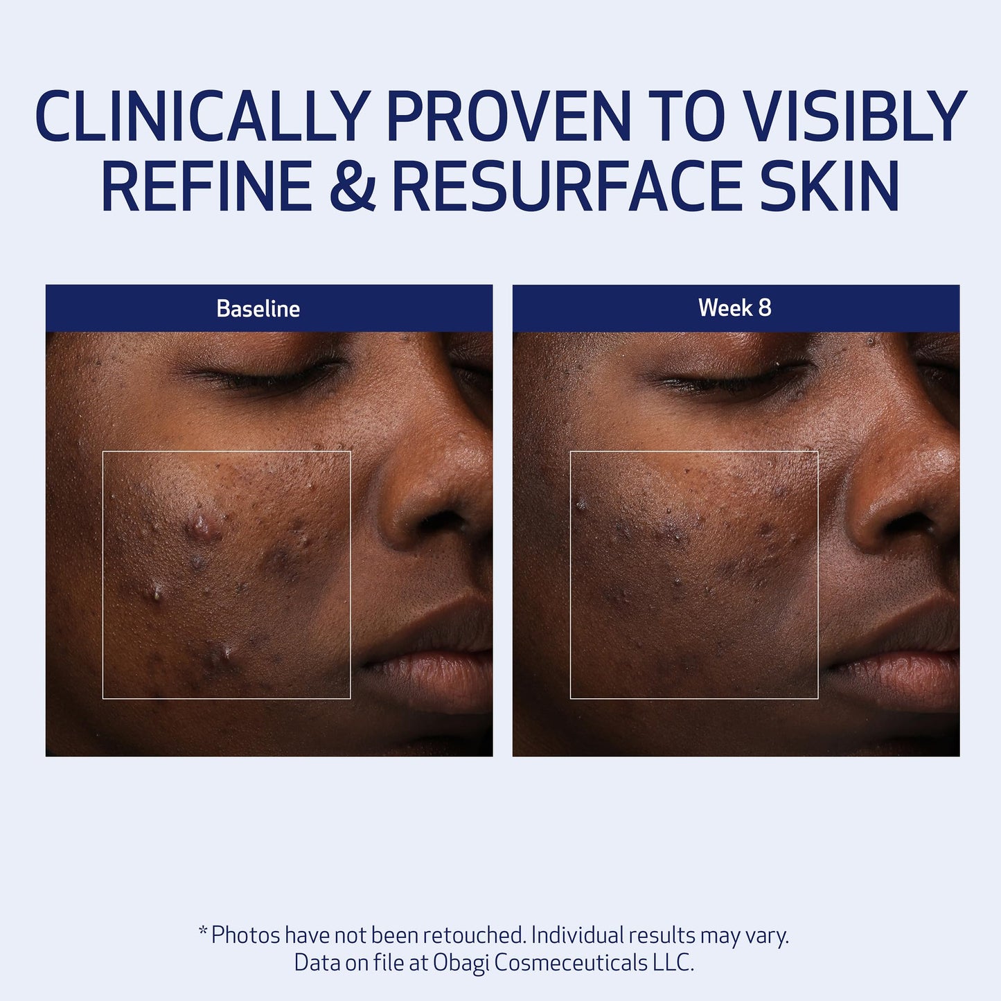 Obagi Medical Retinol + PHA Refining Night Cream – Overnight Anti-Aging, Smoother Skin & Even Complexion | 1.7 oz