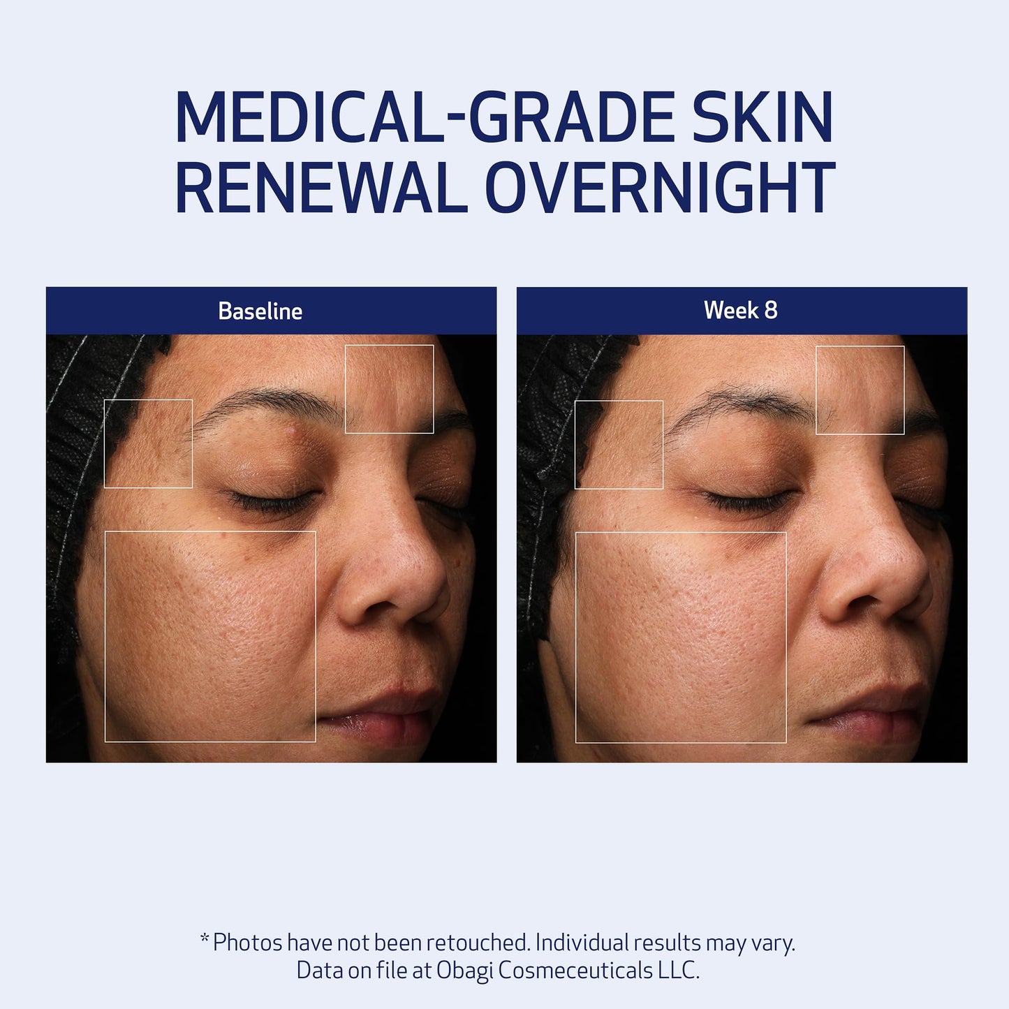 Obagi Medical Retinol + PHA Refining Night Cream – Overnight Anti-Aging, Smoother Skin & Even Complexion | 1.7 oz