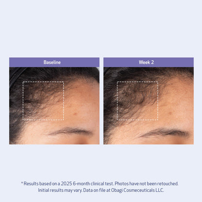 Obagi Nu-Cil BioStim Hair Serum with Biotin – Fuller, Denser Hair & Healthy Scalp (2 oz)