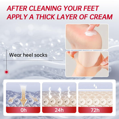 OCSINL Urea Cream 40% for Feet – Deep Repair, Moisture & Free Heel Covers (5.29 oz)