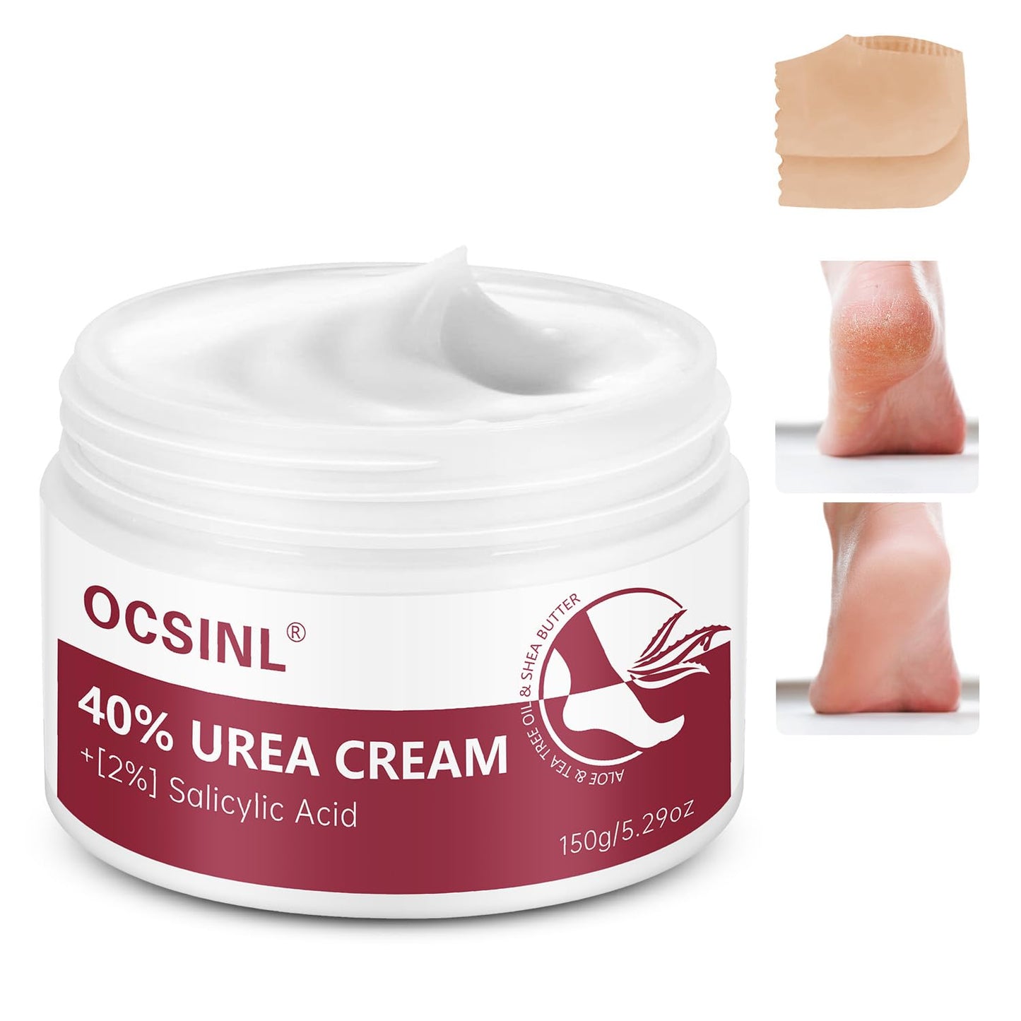 OCSINL Urea Cream 40% for Feet – Deep Repair, Moisture & Free Heel Covers (5.29 oz)