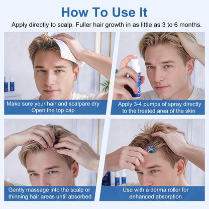 OCVWJKD 5% Minoxidil Spray for Hair Regrowth — Extra Strength 60ml x 7 Bottles