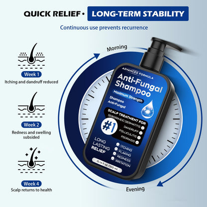 Oely Anti-Dandruff Shampoo for Folliculitis & Scalp Psoriasis | 10.1 fl oz