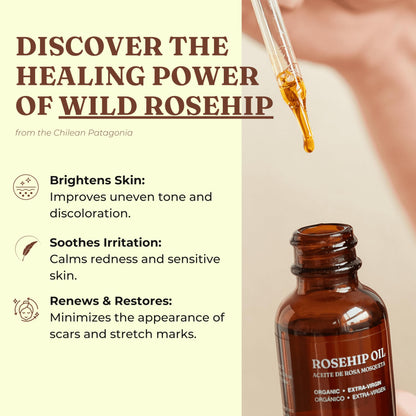 Offernova Organic Rosehip Oil – Cold-Pressed Rosa Mosqueta, USDA Organic, 1 oz