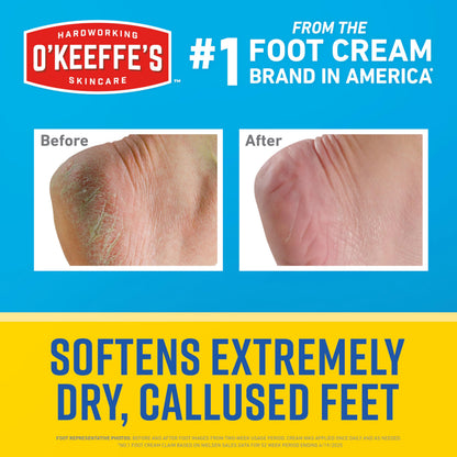 O'Keeffe's for Healthy Feet Intense Renewal Cream with Urea & Alpha Hydroxy Acid, 3 oz Tube