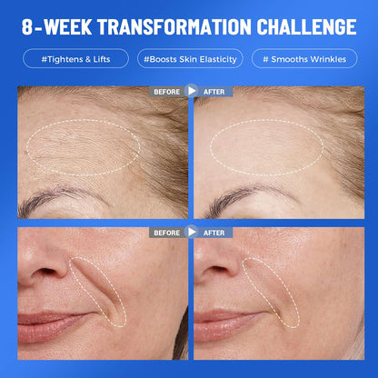 Okela 7-Pack Collagen Hydrogel Masks – Overnight Hydration, Firming & Brightening