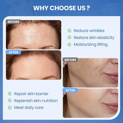 Okela Forehead & Smile Line Patches Overnight — Hydrogel Smoothing Patches