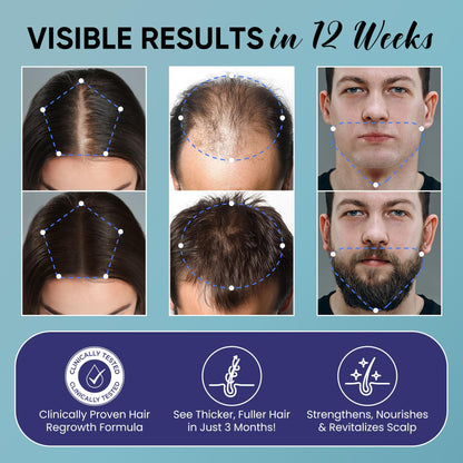 OLIVITA Hair Growth Spray for Men and Women - Safe, Paraben- and Sulfate-Free