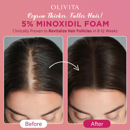 OLIVITA 5% Minoxidil Foam for Women – Extra Strength Hair Regrowth (2x60ml)