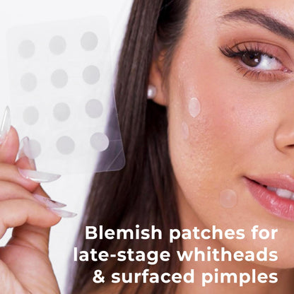 OMMA Korean Pimple Patches – Hydrocolloid Acne Dots, 72 Count, 10mm, Salicylic Acid