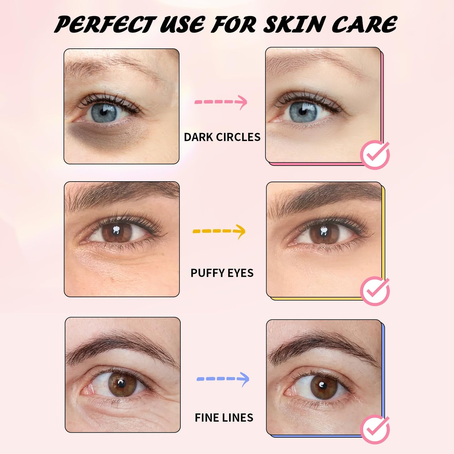 Onespring Eye Masks (36 Pairs) - Caffeine, Retinol, 24K Gold Eye Patches for Puffiness, Dark Circles, Wrinkles