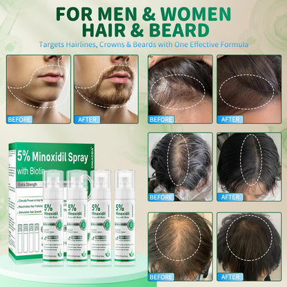 ONIADBA 5% Minoxidil Spray for Hair Growth – 4 Pack (8.12 oz each)