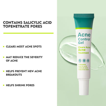 Onkessy Azelaic Acid Serum — 10% Azelaic + Salicylic Acid for Acne & Pore Refinement, 30ml