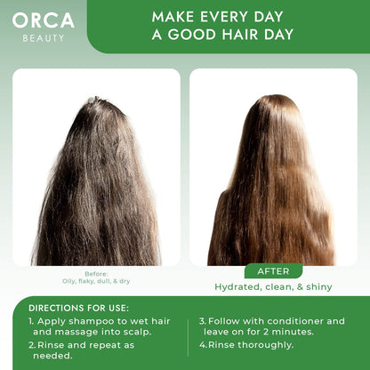 Orca Beauty Tea Tree Shampoo & Conditioner Set 2x16oz – Dandruff Care for Oily Hair