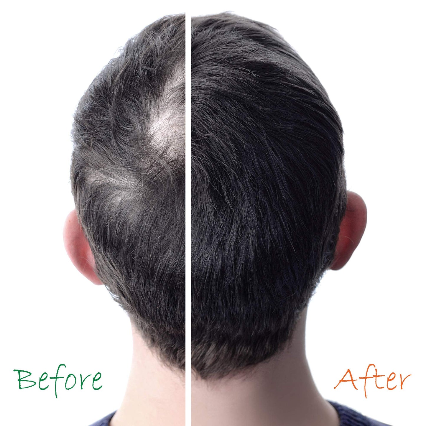 Organic Hair Energizer Hair Growth Booster – B5 Vitamin Serum (2 Pack, 6 oz) for Color-Treated Hair