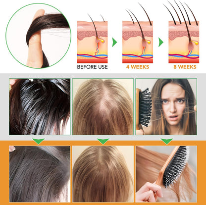 O.SECERT Biotin Shampoo & Conditioner for Hair Loss — Thickening Formula with Rosemary, Black Castor & Batana Oil