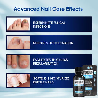 OSIMOON Fungus Treatment for Toenails – Extra Strength, Fast Acting, 2-Pack