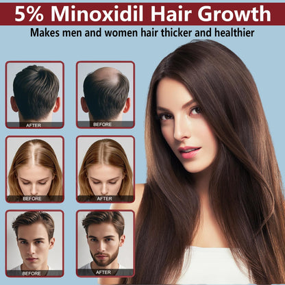 OURMUST 5% Minoxidil Hair Growth Cream – Extra Strength for Men & Women, 2 Bottles