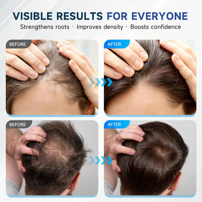 OVEXLIO Hair Growth Shampoo with Biotin & Rosemary – Sulfate-Free Routine for Thinning Hair (11.84 fl oz)