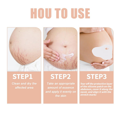 OWILIWO Silicone Belly Patches – Reusable Patch for Stretch Marks & Wrinkles (2pcs)