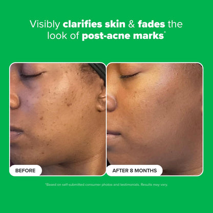Paula's Choice BOOST 10% Azelaic Acid Booster Cream Gel – Fragrance-Free, Oil-Free Serum (0.17 fl oz)