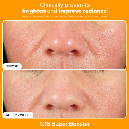 Paula's Choice Brighter Days Ahead Kit – Vitamin C, Mandelic Acid & SPF 50