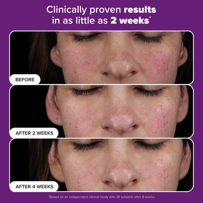 Paula’s Choice Pro Retinaldehyde Dual-Retinoid Serum — High Potency Anti-Aging for Breakout-Prone Skin