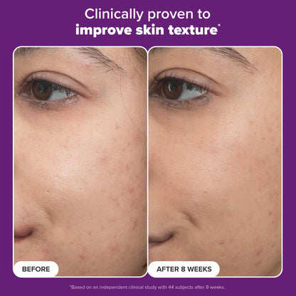 Paula’s Choice Pro Retinaldehyde Dual-Retinoid Serum — High Potency Anti-Aging for Breakout-Prone Skin