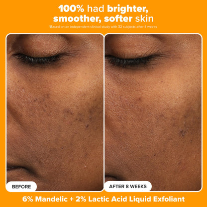Paula's Choice Brighter Days Ahead Kit – Vitamin C, Mandelic Acid & SPF 50