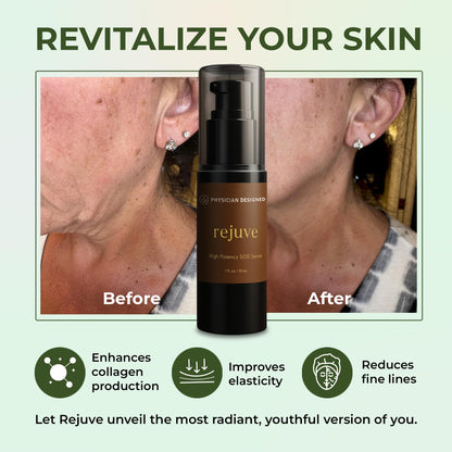 PD VARS Rejuve SOD Serum – Hyaluronic Acid & Ceramides (30ml)
