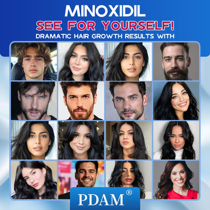 Pdam 5% Minoxidil Foam for Men & Women – Hair Growth Treatment (2 x 2.11 oz)