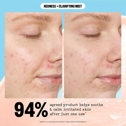 PEACE OUT Redness + Clarifying Mist — Hypochlorous Facial Spray for Acne-Prone Skin