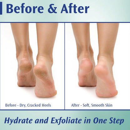 Pedifix Podiatrists' Choice 20% Urea Foot Cream – Extra Strength Callus Control, 4 oz